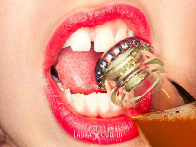 How to Take Care of Veneers