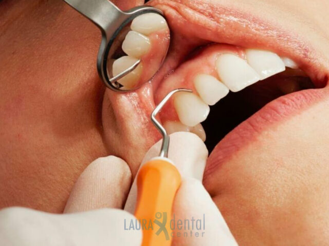 The Importance of Regular Dental Checkups