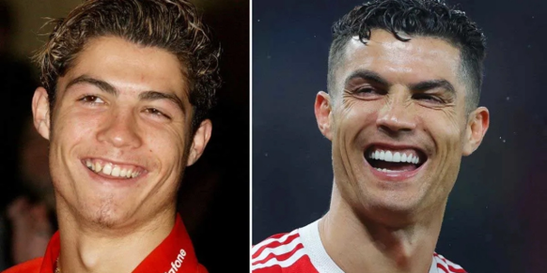 Cristiano Ronaldo teeth and smile makeover