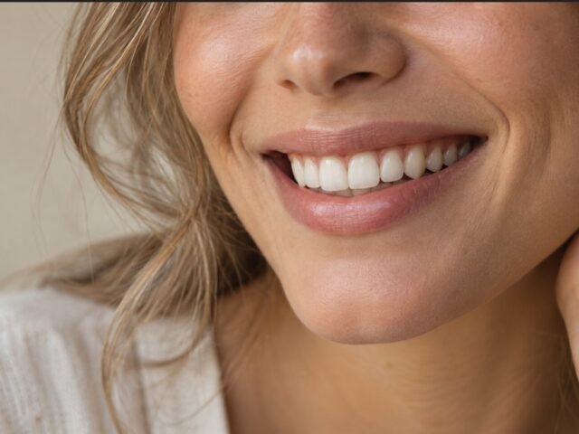 Hollywood Smile vs. Natural